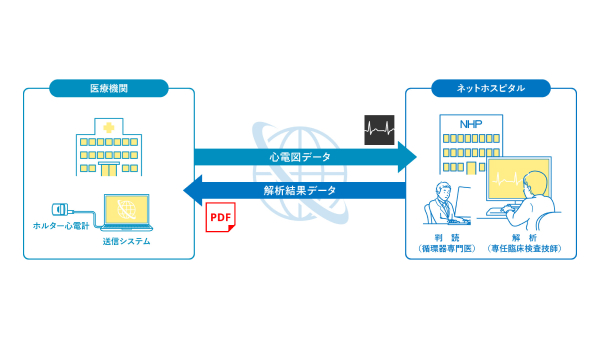 ホルター心電図解析